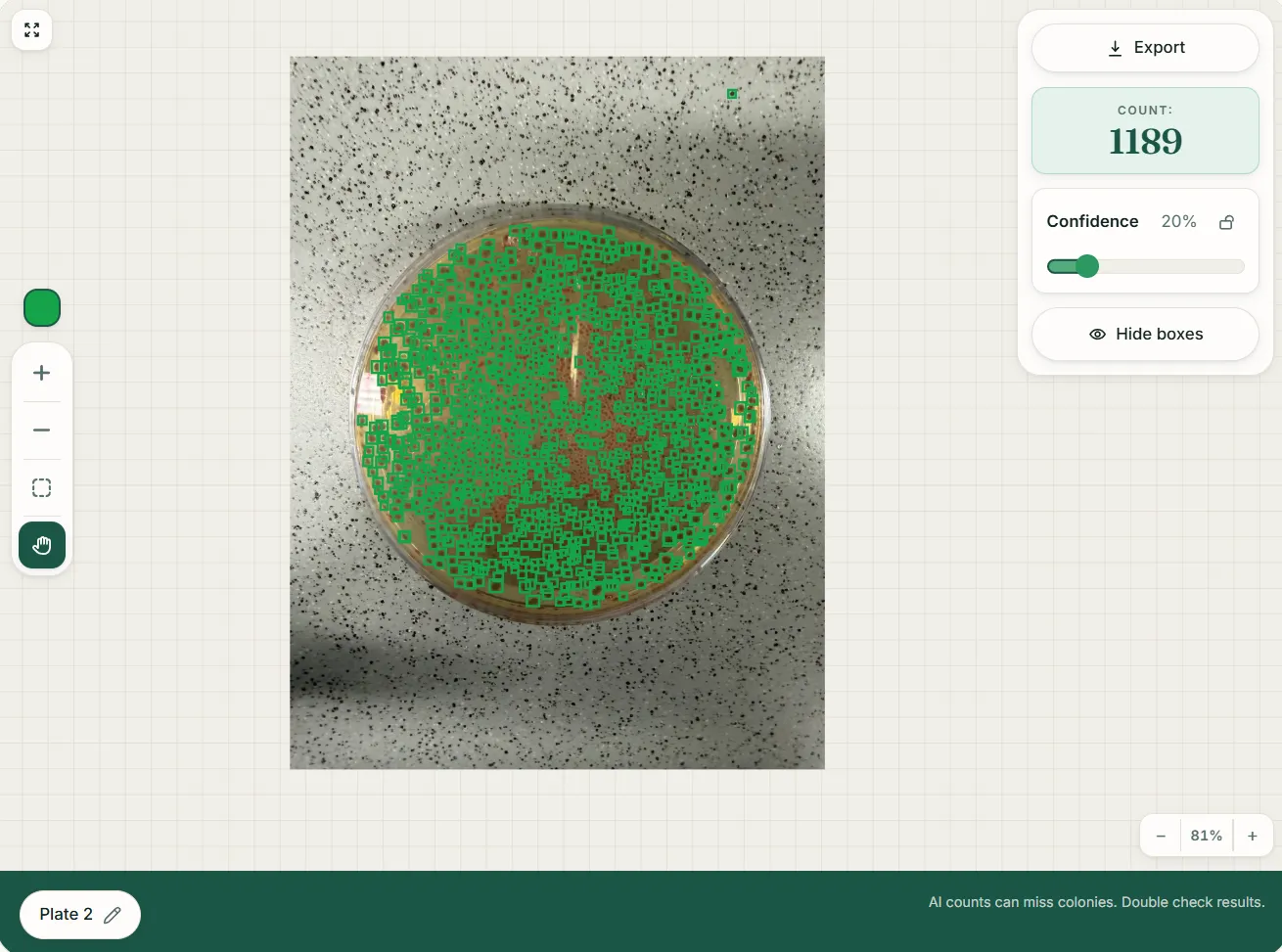 How to Count Bacterial Colonies on Agar Plates | Colony Counter